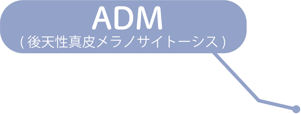 ADM